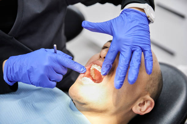 Best Chipped Tooth Repair Near Me  in Lake Ripley, WI